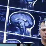 Η εφηβεία του εγκεφάλου διαρκεί μέχρι τα… 32 διαπίστωσε νέα μελέτη