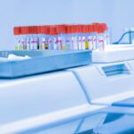 Συνολικά 18 παιδιά γεννήθηκαν στην Ελλάδα από τον δότη σπέρματος με καρκινικό γονίδιο