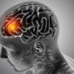 Οι «εγκεφαλικοί σεισμοί» που μπορούν να αλλάξουν όσα γνωρίζουμε για τη σχιζοφρένεια