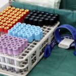 ΠΟΥ: Χαμηλός ο κίνδυνος εξάπλωσης του θανατηφόρου ιού Νίπα έξω από την Ινδία