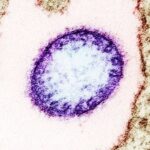 Τι είναι ο ιός Νίπα και πόσο κινδυνεύουμε; Επτά ερωτήσεις – απαντήσεις με όσα πρέπει να ξέρουμε